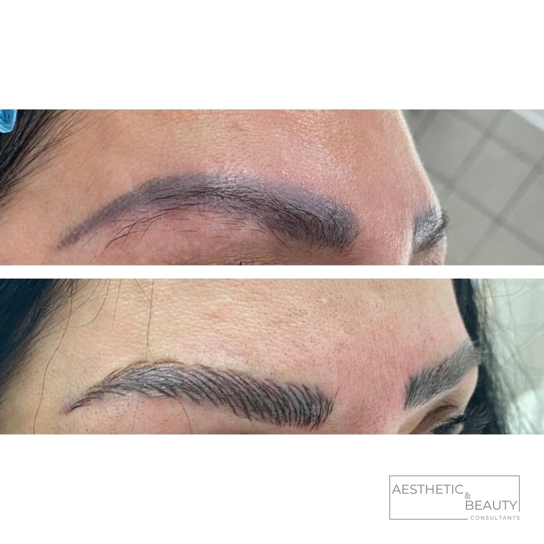 Brow shaping — before and after