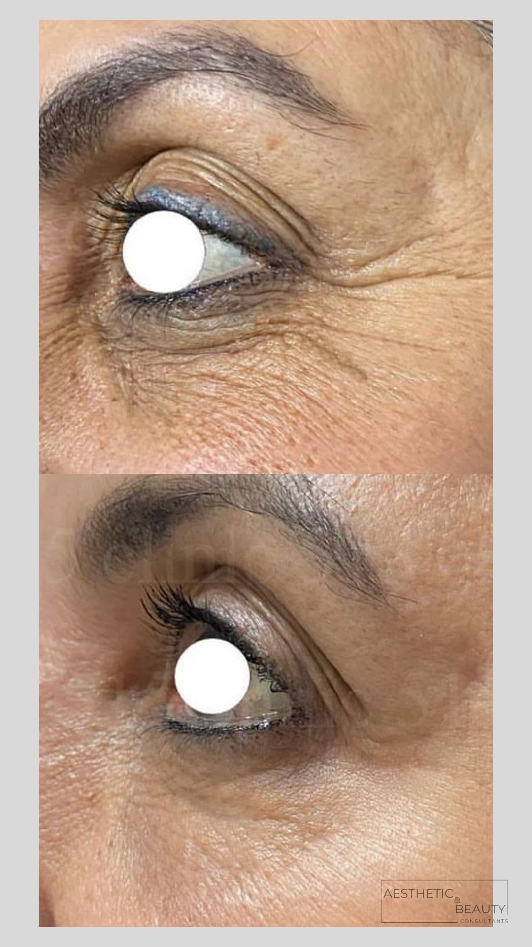 Brows & lashes — before and after